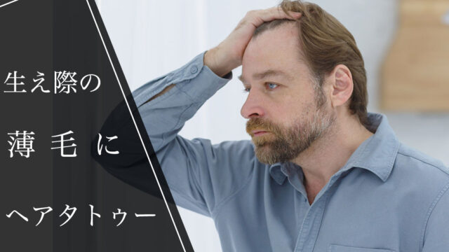 生え際の薄毛は「ヘアタトゥー」で確実に隠せる。料金相場についても解説