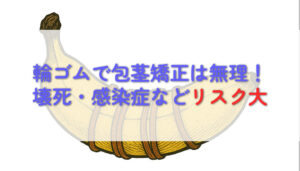 【禁忌】輪ゴムで包茎は矯正できない。家にあるもので包茎治療は可能か考察する