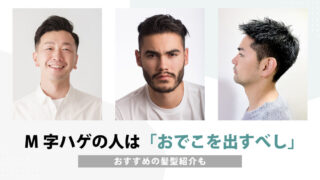 M字ハゲを隠す＝生え際を見せる⁉｜理由とおすすめ髪型紹介も