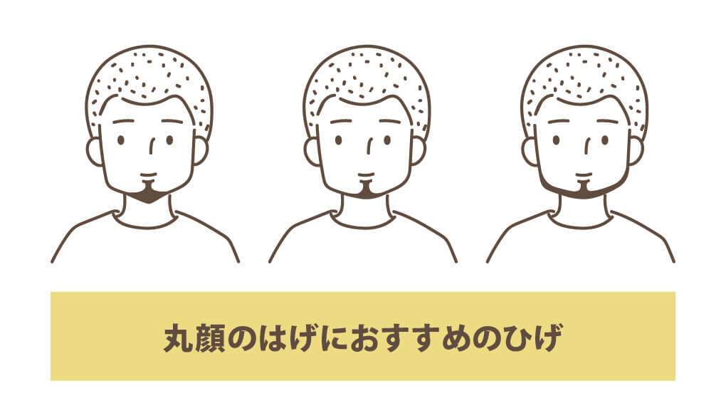 丸顔のはげにおすすめのひげ